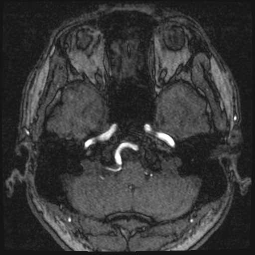 Click on the Serie image to view the images of VILLANUEVA, WILLIAM A.